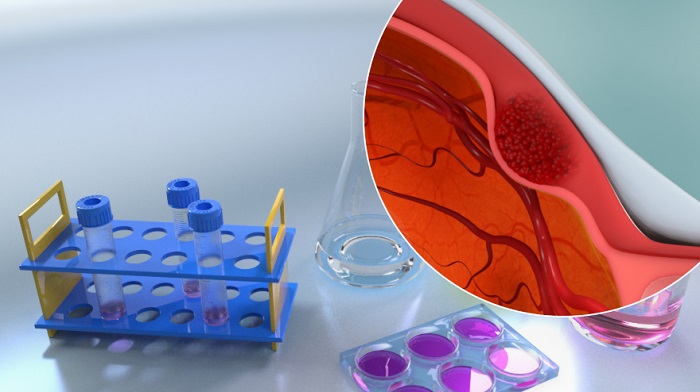 Laboratory equipment and uveal melanoma